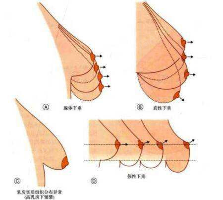 怎样能让乳房变大 怎样使乳房变大一点